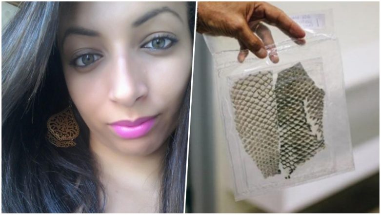 Woman Born Without A Vagina Gets Reconstructed With Tilapia Fish Skin