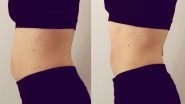 How To Reduce Pregnancy Belly? Lose Your 'Mummy Tummy' With This Simple Exercise