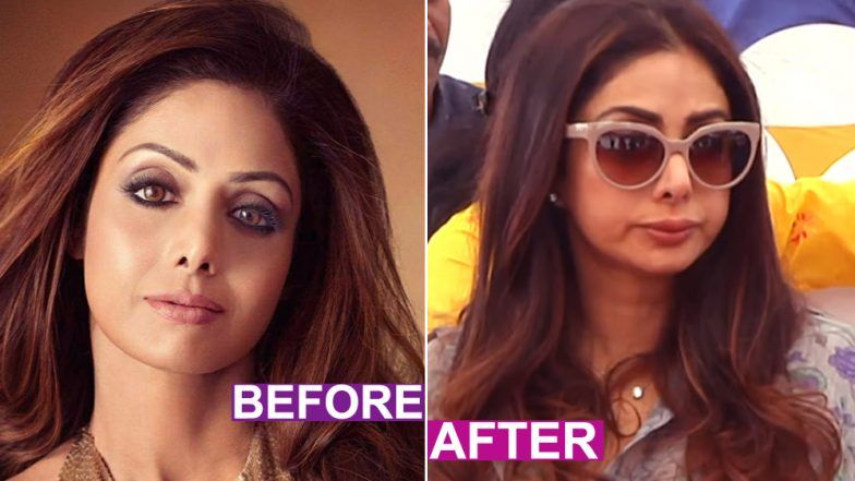 Sridevi’s Plastic Surgery Goes WRONG? Viral Video Claims