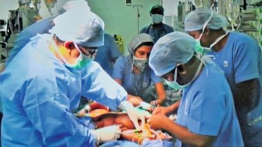 Meghalaya Doctors Remove 24 kg Tumour From a 37-Year-Old Woman's Abdomen