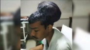Mumbai: Doctors Remove 'World's Largest Brain Tumour'