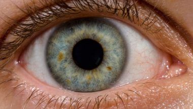 Diabetes Patients Have Double the Chances to Develop Cataract: Study