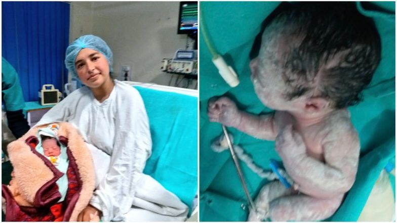 Sunjwan Miracle: Pregnant Woman Wounded in Jammu Army Camp Attack Delivers Baby, Watch Video