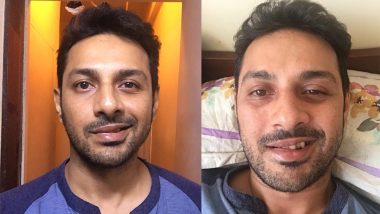 After His Fight With Kangana Ranaut Simran Writer Apurva Asrani Suffers From Bell's Palsy