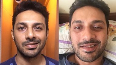 Bollywood Writer Apurva Asrani Suffers From Facial Paralysis: Here’s Everything You Want to Know About Bell’s Palsy