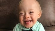 World Down Syndrome Day: Famous People With Down Syndrome Who Changed The Way World Views The Condition