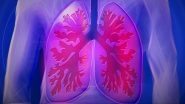 Scientists Decode How Lungs Are Damaged in Severe COVID-19 Using Novel Imaging Technique