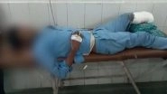 Doctors Use Amputated Leg of Patient as Pillow at Jhansi Hospital in Uttar Pradesh, Suspended