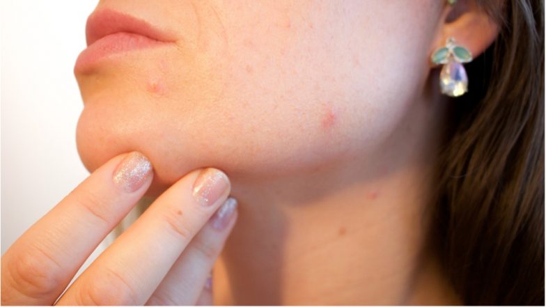 Make-Up for Acne-Prone Skin: Tips for Hiding Blemishes &amp; Pimples on Oily Skin