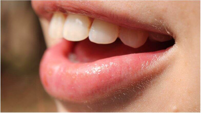 Oral Bacteria May Up Risk of Pancreatic Cancer Oral Bacteria May Up Risk of Pancreatic Cancer