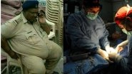 Shobha De Fat-Shaming: Did you know these 6 Benefits of Bariatric Surgery Apart from Weight Loss?