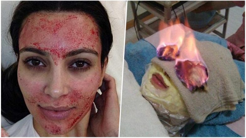 From Semen to Bird Poop, Weird Skin Masks and Treatments That Are Sure to Gross You Out