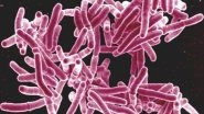 TB Remains World's Deadliest Infectious Disease: WHO