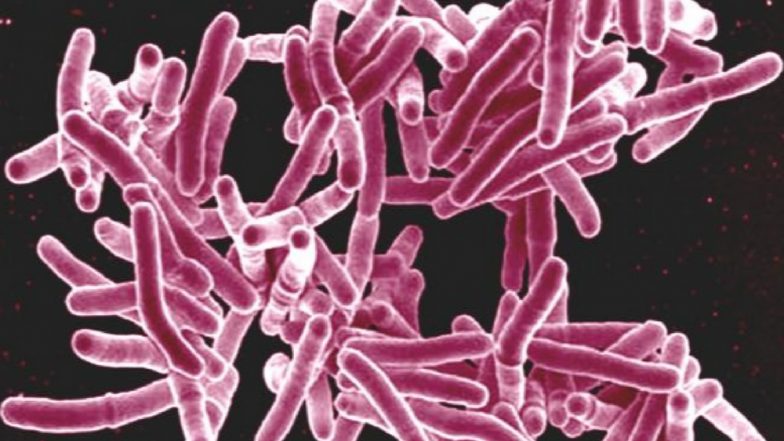 TB Remains World's Deadliest Infectious Disease: WHO