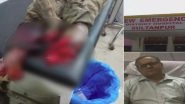 Sultanpur Horror: Patient Whose Leg Was Separated in Accident Left Unattended on Stretcher For Two Hours