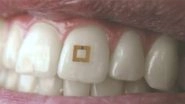 Now a Tooth Sensor Can Trace What you Eat and Keep you Healthy