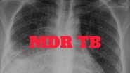 Has India Failed at Tackling Multi-Drug Resistant Tuberculosis?