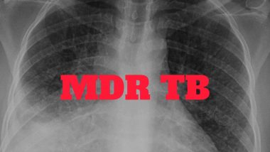 Has India Failed at Tackling Multi-Drug Resistant Tuberculosis?