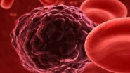 New Class of Drugs May Help Tackle Resistant Cancers