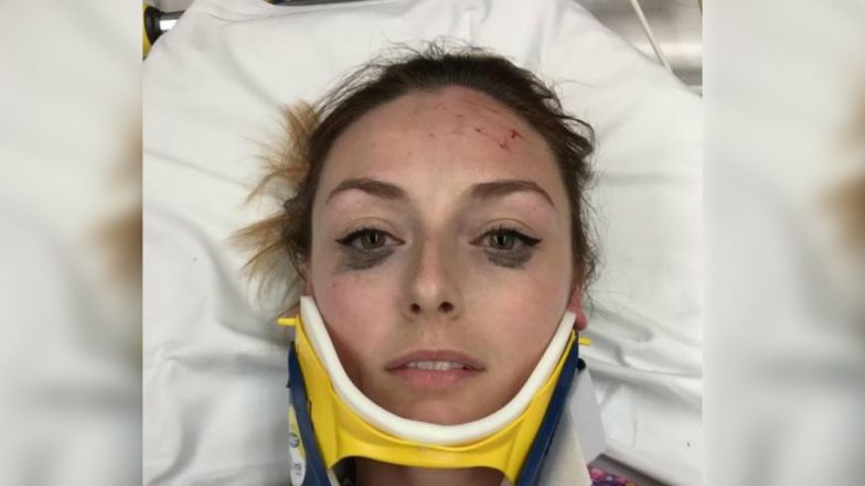 This Woman Had Her Eyeliner Game on Point Even After an Accident and Her Review is Going Viral