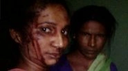 Indian Woman Bravely Fights off a Tiger With a Stick, Takes a Selfie After Surviving the Attack