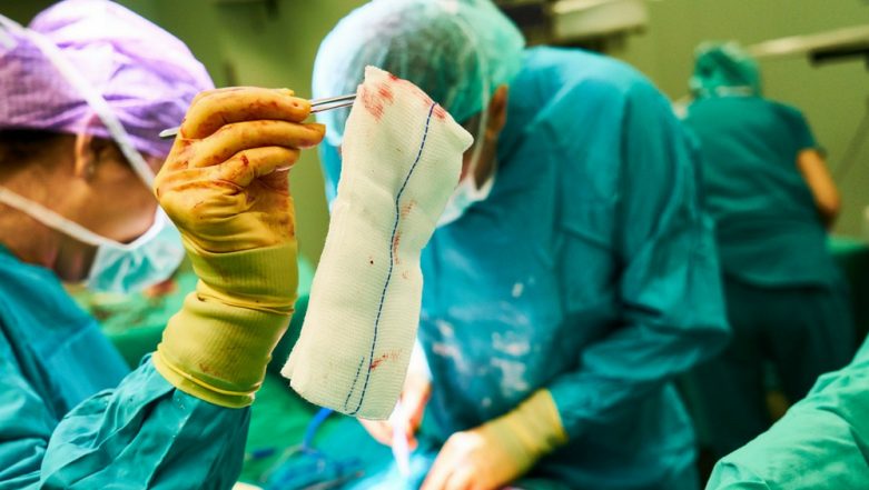 Delhi: Doctors at Indraprastha Apollo Hospital Remove 50 Kg Ovarian Tumour in 3.5-Hour Operation