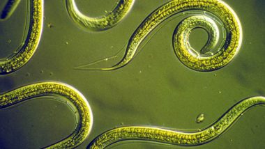 Fourteen Roundworms Removed From 38-Year-Old Woman's Bile Duct