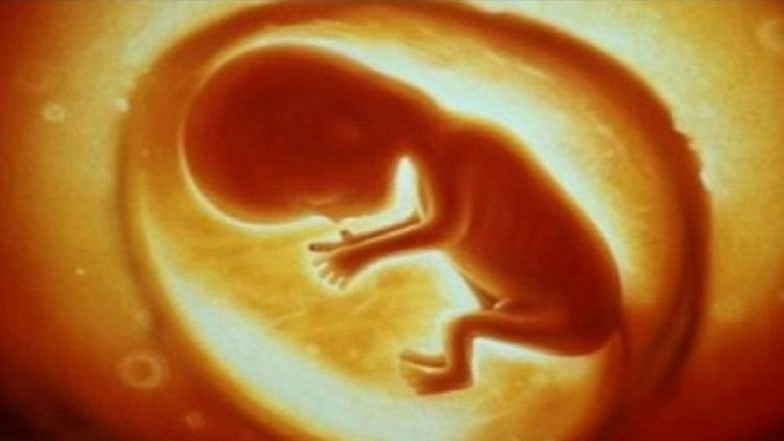 Mumbai: 2 Fake Doctors Held for Running Illegal Abortion Clinic & Sex Determination Test