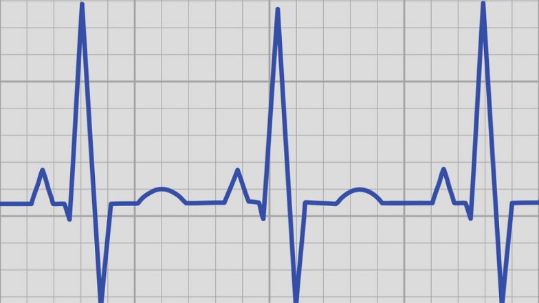 Resting Heart Rate More Sensitive Indicator of COVID-19: Study
