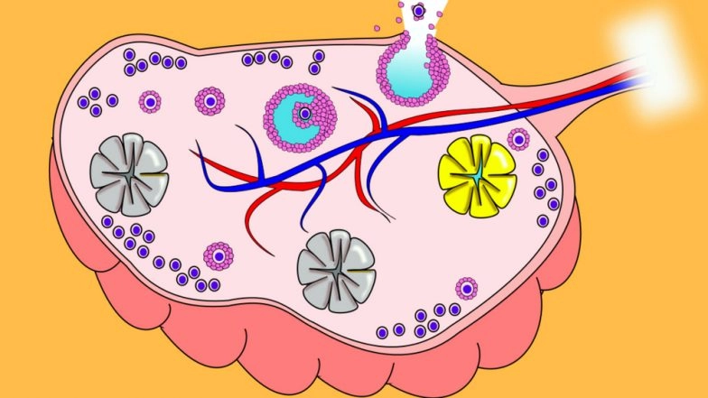 PCOS and Libido: How Does Polycystic Ovarian Syndrome Affect Your Sex Life? Does It Cause Delayed Orgasms? Here's What You Need to Know
