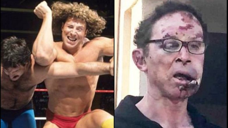Tom Magee, Former WWE Wrestler, Beaten by Six Men Over Car Parking Space; Suffers Multiple Injuries