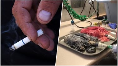 Want to Quit Smoking? Watch This Alarming Video of a Smoker’s Lungs Shared by a Nurse