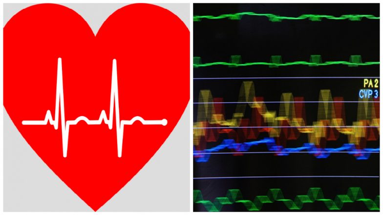 Kolkata Sees its First Heart Transplant, Organ Flown in From Bengaluru Passed Through Green Corridor
