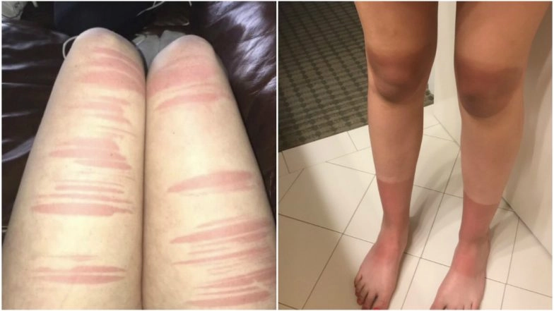 Summer Fashion: Here's Why Your Ripped Jeans Are a Strict No-No On Sunny Days