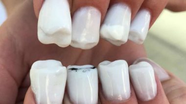 Scary 'Teeth Nails' is The Newest Nail Art Trend on Instagram (Watch Video)