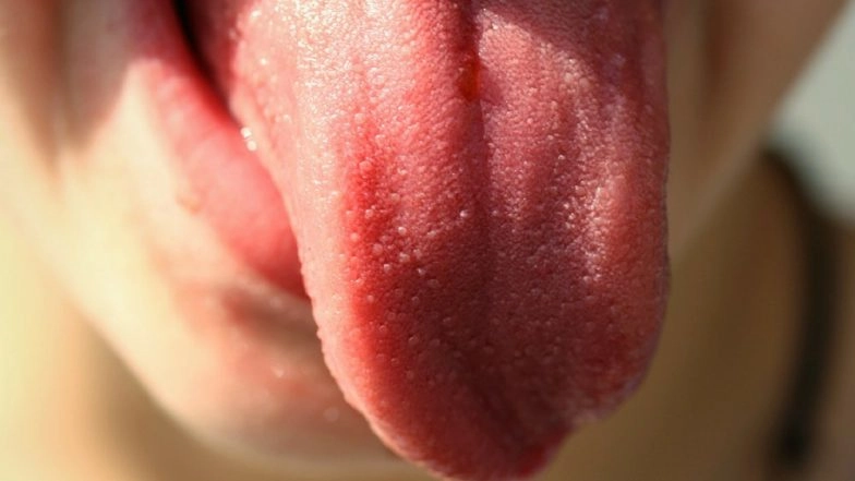 Bhilai Youth Congress Leader's Tongue Chopped Off Due to an Alleged Political Rivalry
