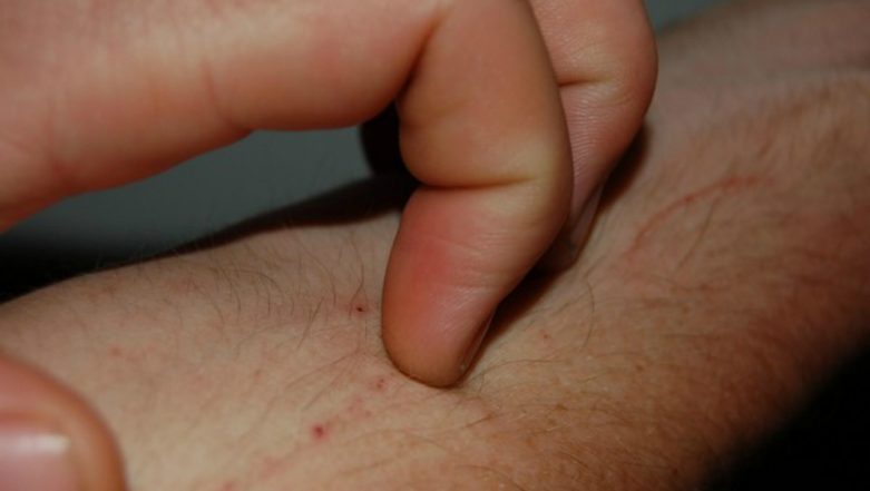 China Man Turns Back Scratching Into Big Business, Makes INR 14 Lakh Monthly From ‘Itch Relief’ Service