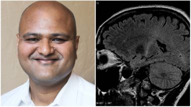 Indian Scientist Gets Diagnosed With ALS, Ironically The Disease He Was Researching On