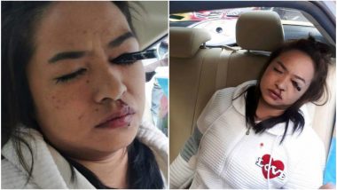Applying Makeup in a Moving Car is Dangerous! This Woman Had Her Eyeliner Stuck in Eye After Freak Accident