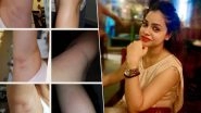Sumona Chakravarti Slams UrbanClap's Shoddy Beauty Services That Left Her Skin Blotched And Bruised - view pic