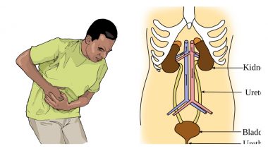 Urinary Tract Infection: How To Stay Safe From UTI This Monsoon