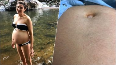 Unusual Side-Effect of Pregnancy! Mum-to-Be Shares A Pic of Her Hairy Belly, Calls it 'Hagrid'