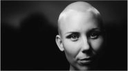 Hair Loss & Chemotherapy: Why it Happens & What to Expect During Cancer Treatment
