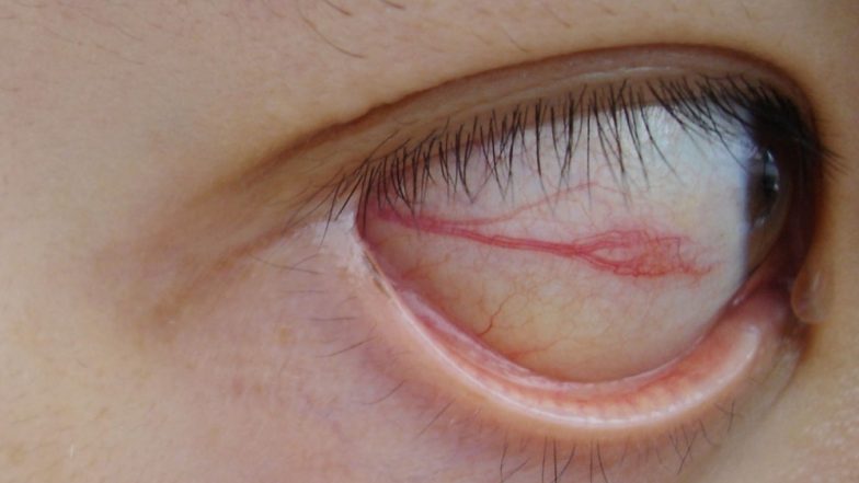 Pakistani Eyeliner Suspected of Causing Lead Poisoning in Australia; 3 Children Taken Ill