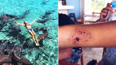 Looking For Perfect Instagram Picture? Model Gets Shark Bites While Photoshoot
