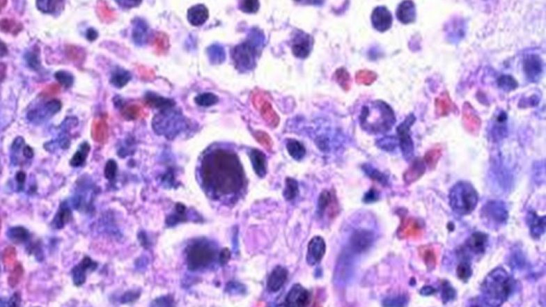 Researchers Find Quiet Viruses Alter Body’s Response to Vaccines, Pathogens
