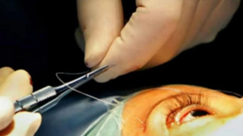 National Eye Donation Fortnight: 15 Facts About Eye Donation You Should Know