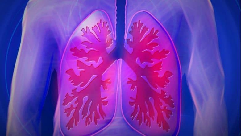 More Women Falling Prey to Lung Cancer: Study More Women Falling Prey to Lung Cancer: Study