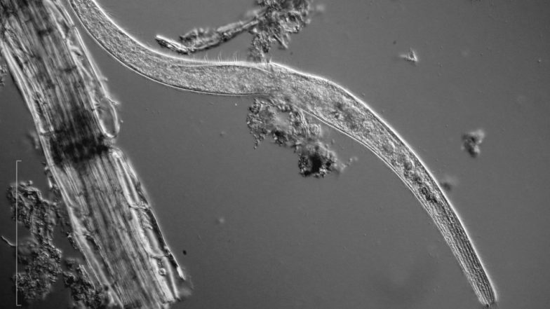 World's Fastest and Smallest Creature Is a Protozoan Which Can Beat an F1 Car In Speed