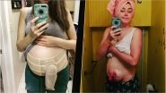 Pregnant with Flesh-Eating Infection! Mother of Two Shares Her Real-Life Story
